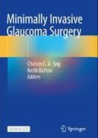 Image of E-book Minimally Invasive Glaucoma Surgery